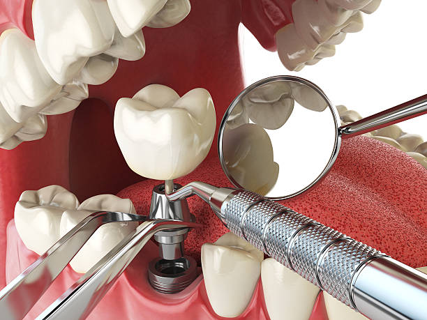 Best Emergency Treatment for Jaw Pain or Injury in Marion, VA